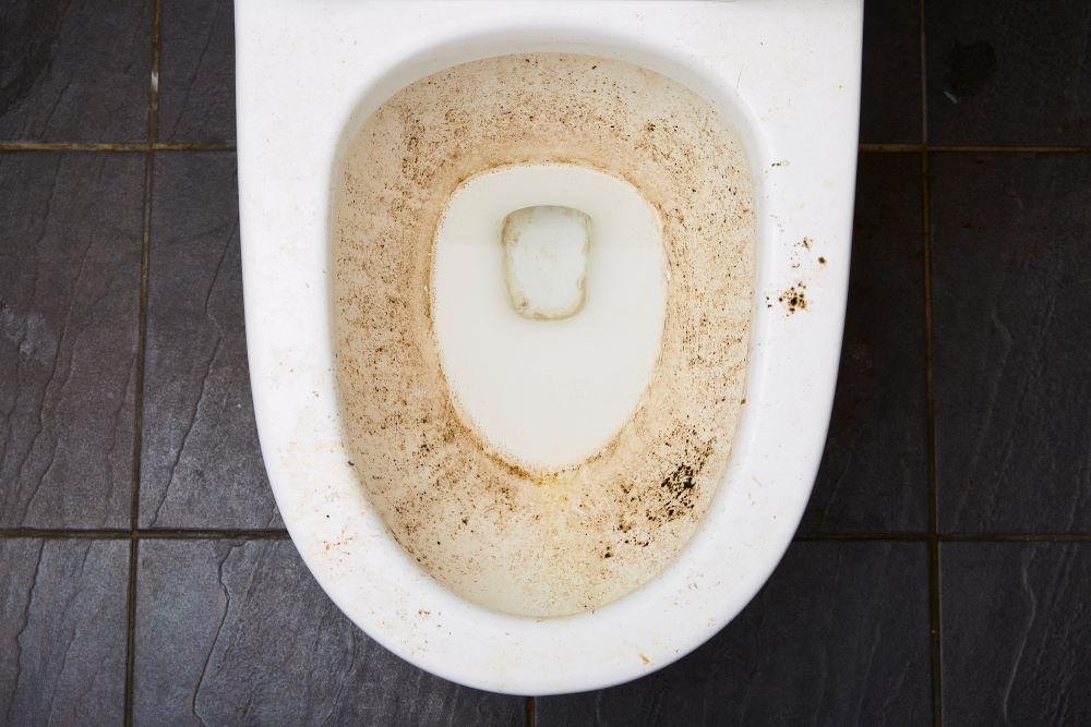 Dirty and stains on toilet bowl 